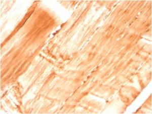 Immunohistochemical analysis of formalin-fixed, paraffin-embedded human skeletal muscle using Anti-Dystrophin Antibody [DMD/3677]