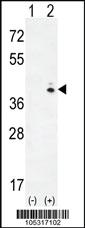 Anti-GALK1 Rabbit Polyclonal Antibody