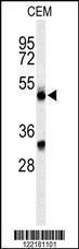 Anti-CFP Rabbit Polyclonal Antibody (FITC (Fluorescein Isothiocyanate))