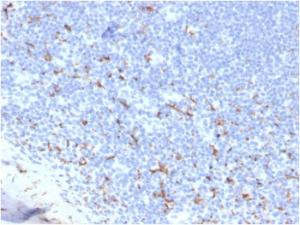 Immunohistochemical analysis of formalin-fixed, paraffin-embedded human tonsil using Anti-CD163 Antibody [M130/3708R]