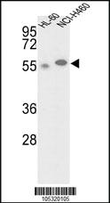 Anti-GALK2 Rabbit Polyclonal Antibody