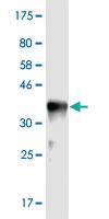 Anti-USP47 Mouse Monoclonal Antibody [clone: 1E6]