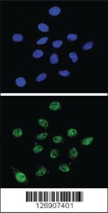 Anti-DKC1 Rabbit Polyclonal Antibody