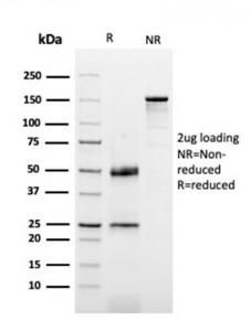 SDS-PAGE analysis of Anti-Dystrophin Antibody [DMD/3677] under non-reduced and reduced conditions; showing intact IgG and intact heavy and light chains, respectively. SDS-PAGE analysis confirms the integrity and purity of the Antibody