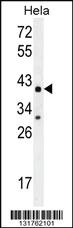 Anti-C2 Rabbit Polyclonal Antibody