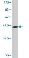 Anti-SPRR3 Mouse Polyclonal Antibody