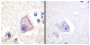 Immunohistochemical analysis of paraffin-embedded human brain using Anti-SEK1 (phospho Ser257) Antibody. The right hand panel represents a negative control, where the antibody was pre-incubated with the immunising peptide