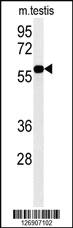 Anti-DKC1 Rabbit Polyclonal Antibody