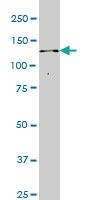 Anti-ITPKB Mouse Monoclonal Antibody [clone: 2F8]