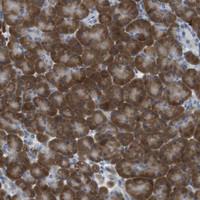 Anti-CLPTM1L Rabbit Polyclonal Antibody