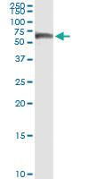 Anti-CALCOCO2 Polyclonal Antibody Pair