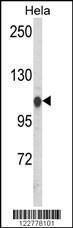 Anti-HSPA4L Rabbit Polyclonal Antibody (Biotin)