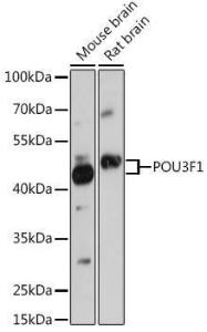 Western blot analysis of extracts of various cell lines, using Anti-Oct6 Antibody (A307073) at 1:1,000 dilution The secondary antibody was Goat Anti-Rabbit IgG H&L Antibody (HRP) at 1:10,000 dilution Lysates/proteins were present at 25 µg per lane