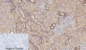 Anti-MMP9 Rabbit Polyclonal Antibody