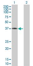 Anti-CFHR1 Mouse Polyclonal Antibody