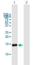 Anti-G0S2 Mouse Polyclonal Antibody