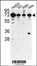 Anti-PHACTR2 Rabbit Polyclonal Antibody