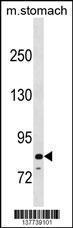 Anti-PADI6 Rabbit Polyclonal Antibody (Biotin)