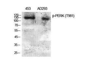 Western blot analysis of various cells using Anti-PERK (phospho Thr981) Antibody