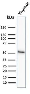 Western blot analysis of human thymus tissue lysate using Anti-Cytokeratin 15 Antibody [KRT15/2958]