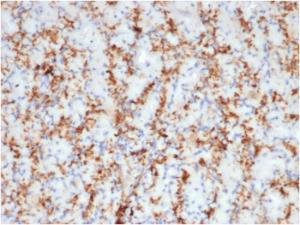 Immunohistochemical analysis of formalin-fixed, paraffin-embedded human spleen using Anti-CD163 Antibody [M130/3708R]