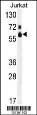 Anti-P100 Mouse Monoclonal Antibody