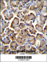 Anti-CD34 Rabbit Polyclonal Antibody