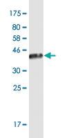 Anti-JSRP1 Mouse Monoclonal Antibody [clone: 6A9]