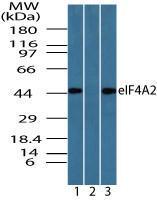 Anti-EIF4A2 Rabbit Polyclonal Antibody