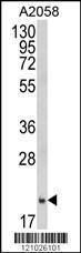 Anti-FTH1 Rabbit Polyclonal Antibody (AP (Alkaline Phosphatase))