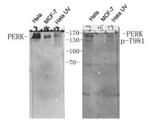 Western blot analysis of various cells using Anti-PERK (phospho Thr981) Antibody