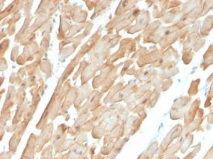 Immunohistochemical analysis of formalin-fixed, paraffin-embedded human cardiac muscle using Anti-Dystrophin Antibody [DMD/3677]