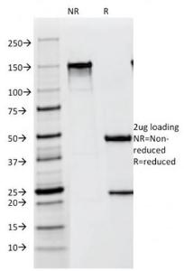 SDS-PAGE analysis of Anti-Melanoma gp100 Antibody [NKI-beteb] under non-reduced and reduced conditions; showing intact IgG and intact heavy and light chains, respectively. SDS-PAGE analysis confirms the integrity and purity of the antibody