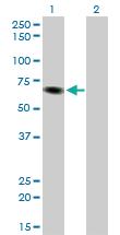 Anti-ITPKB Mouse Monoclonal Antibody [clone: 2F8]