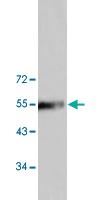 Anti-AKT1 Rabbit Polyclonal Antibody