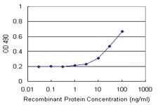 Anti-NADK Polyclonal Antibody Pair