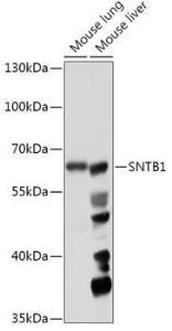 Western blot analysis of extracts of various cell lines, using Anti-SNTB1 Antibody (A307076) at 1:1000 dilution