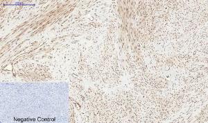 Immunohistochemical analysis of paraffin-embedded human uterus tissue using Anti-PERK (phospho Thr981) Antibody at 1:200 (4°C overnight). Negative control was secondary antibody only.