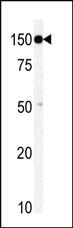 Anti-TAOK1 Rabbit Polyclonal Antibody