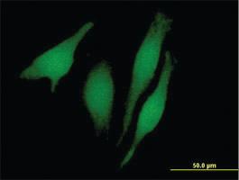 Anti-RUSC1 Mouse Polyclonal Antibody