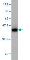 Anti-RAB6A Mouse Monoclonal Antibody [clone: 3G3]