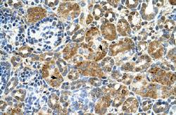 Anti-CSTB Rabbit Polyclonal Antibody