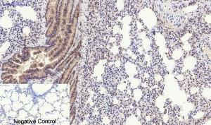 Immunohistochemical analysis of paraffin-embedded rat lung tissue using Anti-PERK (phospho Thr981) Antibody at 1:200 (4°C overnight). Negative control was secondary antibody only.