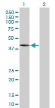 Anti-IVD Mouse Polyclonal Antibody