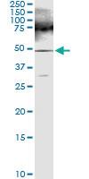 Anti-FARS2 Polyclonal Antibody Pair