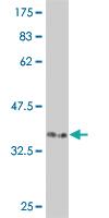 Anti-CDK12 Mouse Monoclonal Antibody [clone: 3C1]