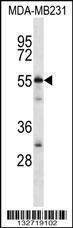 Anti-CG025 Rabbit Polyclonal Antibody (AP (Alkaline Phosphatase))