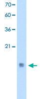 Anti-CSTB Rabbit Polyclonal Antibody