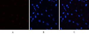 Immunofluorescence analysis of rat heart tissue using Anti-PERK (phospho Thr981) Antibody (red) at 1:200 (4°C overnight). Cy3 labelled secondary antibody was used at 1:300 (RT 50min). Panel A: Target. Panel B: DAPI. Panel C: Merge.