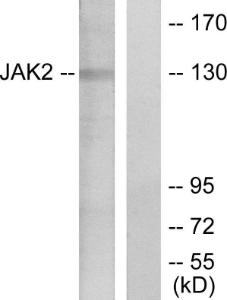 Anti-Jak2 Rabbit Polyclonal Antibody